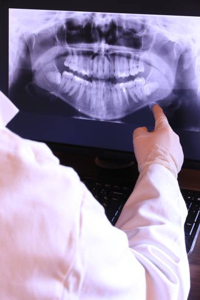Best Emergency Root Canal Treatment in East Merrimack, NH