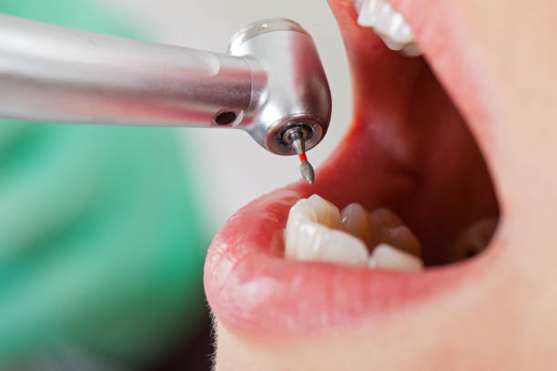 Best Emergency Orthodontic Repairs in East Merrimack, NH
